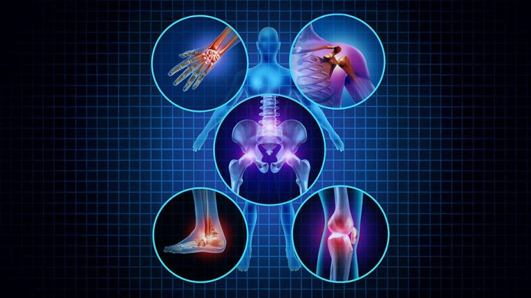 A Targeted Solution for Muscle and Joint Relief